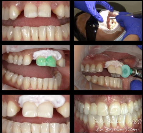 Cosmetic Dentistry at Hamilton Care Dental Centre in Hamilton
