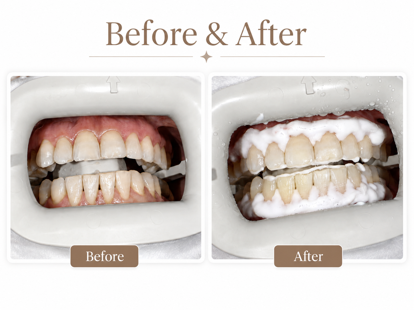 Additional Dental Services at Hamilton Care Dental Centre in Hamilton